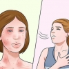 Behandling av allergier