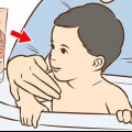Behandling av utslett på babyens nakke