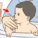 Behandling av utslett på babyens nakke