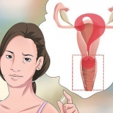 Diagnostisering av vaginal utflod