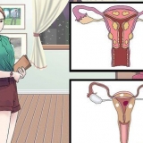 Behandling av vaginale cyster