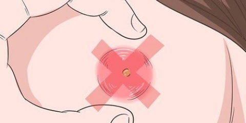 Bli kvitt en abscess