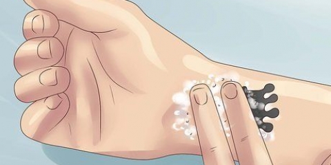 Fjerne en tatovering med salt