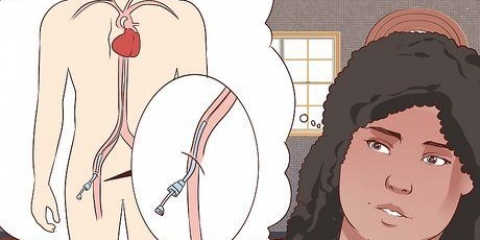 Å komme seg etter en angiografi