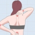 Behandling av en klemt nerve